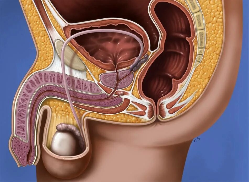 Аденома предстательной железы и дгпж. Эктопия наружного отверстия уретры. Аденомэктомия предстательной железы. Трансуретральная резекция простаты (турп). Уретра простата.