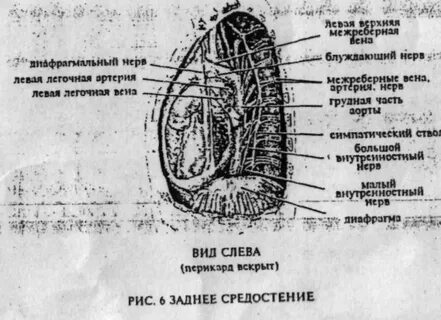 Что значит средостение значимо расширено