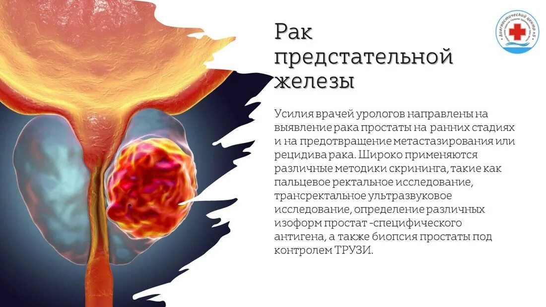 Рак предстательной москва. Онкомаркеры предстательной железы. Карцинома онкомаркеры. Онкомаркер опухоли простаты. Онкомаркер при опухоли простаты.