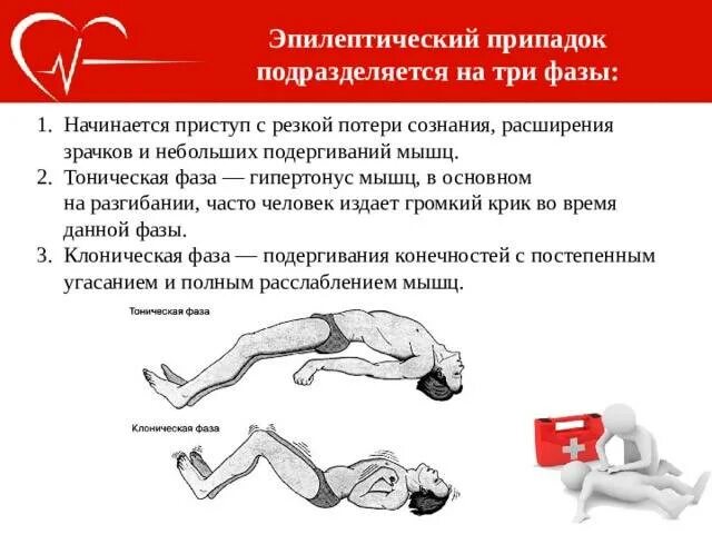 Как предотвратить приступ. Эпилепсия эпилептический приступ. характерные симптомы эпилептического припадка. приступ эпилепсии судороги. при эпилептическом припадке.