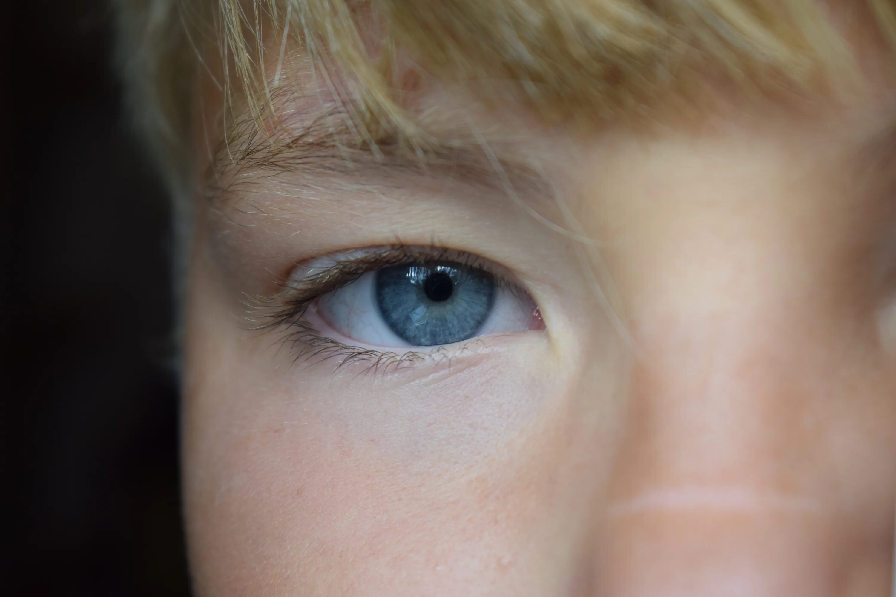 Почему у ребенка голубые глаза. Глаза мальчика. Глаза ребенка. Пятна брушфильда на радужке.