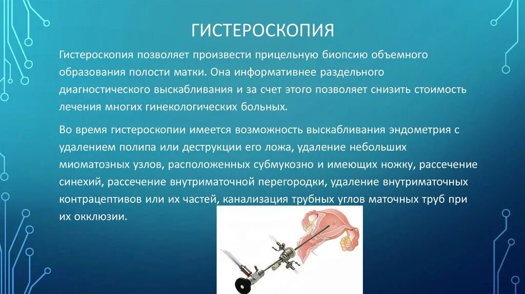 Выскабливание полости матки гистероскопия. Биопсия полипа эндометрия. Гистероскопия этапы операция. Операция гистерорезектоскопия полипа эндометрия. Гистероскопия методика.