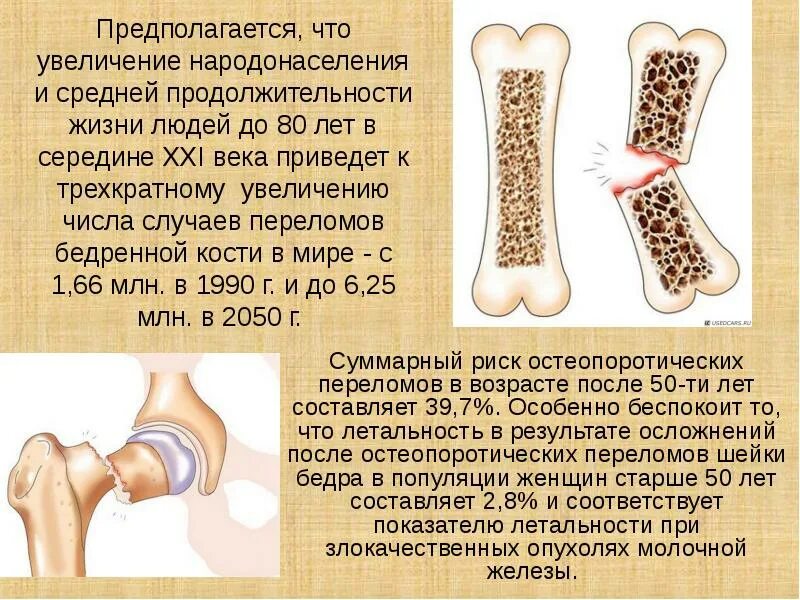 Остеопороз переломы костей. Остеопороз презентация. Изменение костей с возрастом. Переломы при остеопорозе. В химическом составе костей пожилого человека