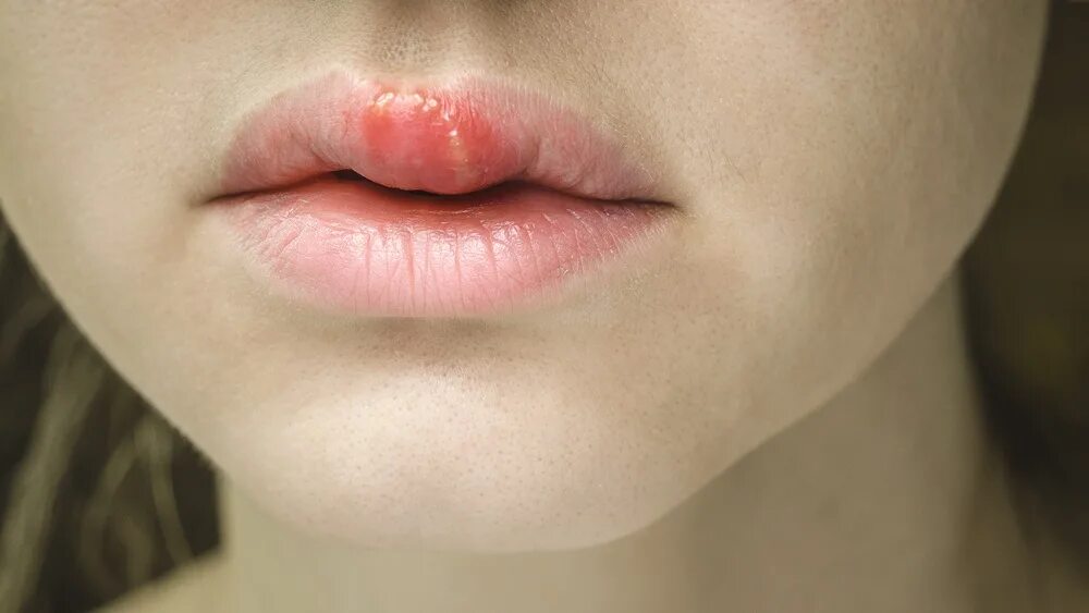 Волосы над верхней губой. Пушковые волосы над верхней губой. Усы у женщин. У девушки на верхней губе. Перманентный макияж губ бантиком.