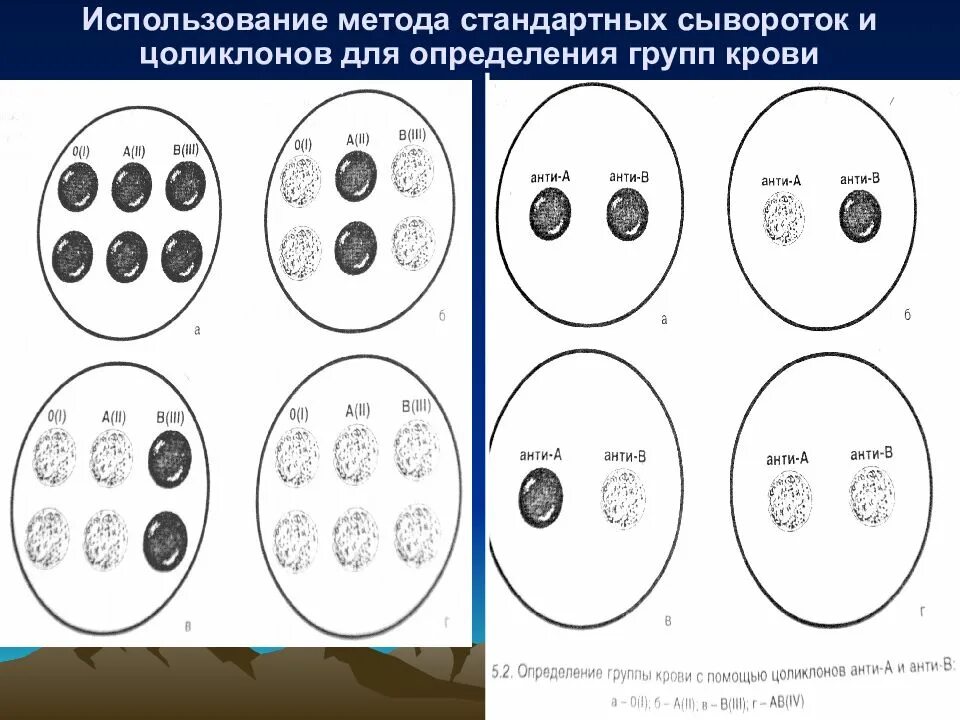 Группа крови с помощью цоликлонов. Определение группы крови сыворотками и цоликлонами. Определение группы крови методом стандартных сывороток. Метод определения группы крови цоликлонами. Определить группу крови с помощью стандартных цоликлонов алгоритм.