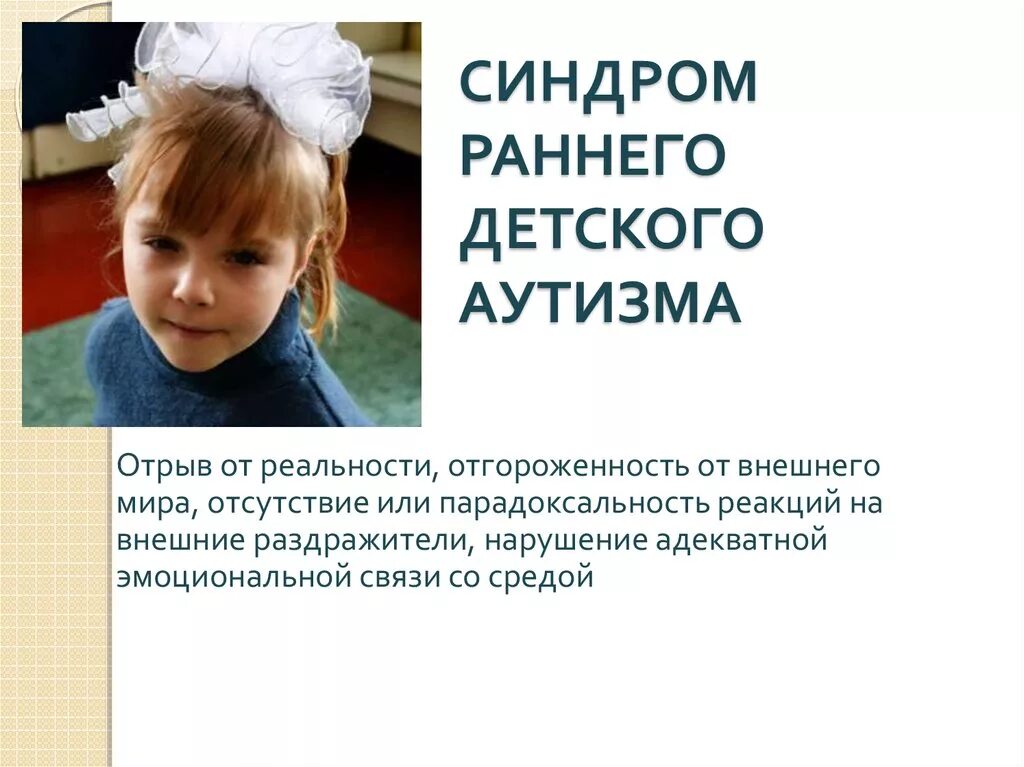 Реферат тақырыбы Аутист балалар