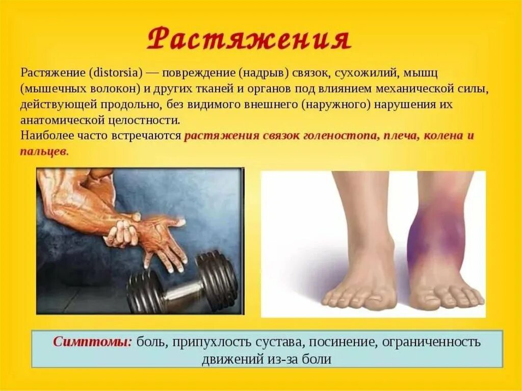 Разрывы мышц и сухожилий. Растяжения, разрывы связок и мышц. растяжения и разрывы связок проявления.