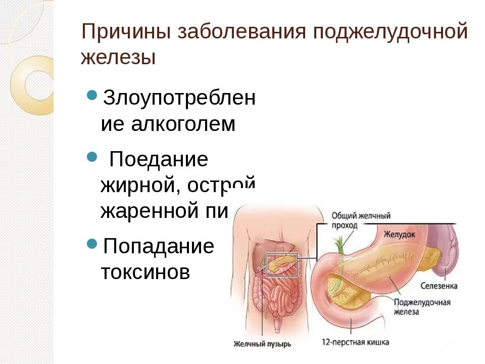 Заболев поджелудочной железы. Воспаление поджелудочной причины. патология поджелудочной железы симптомы. поджелудочная железа предпосылки. причины болезни поджелудочной железы.