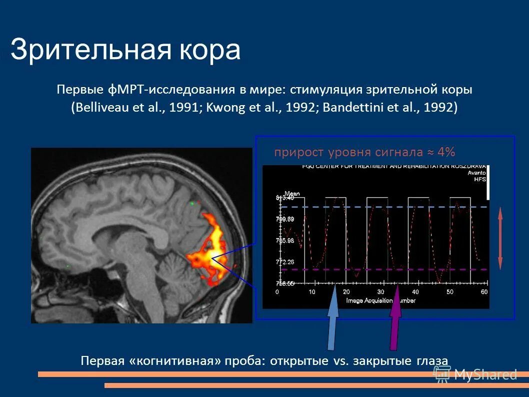 Зрительный анализатор расположен в доле конечного мозга. Шпорная борозда в зрительном анализаторе. Функции первичной и вторичной зрительной коры. Зрительный анализатор расположен в доле конечного мозга. Структуры зрительной коры.
