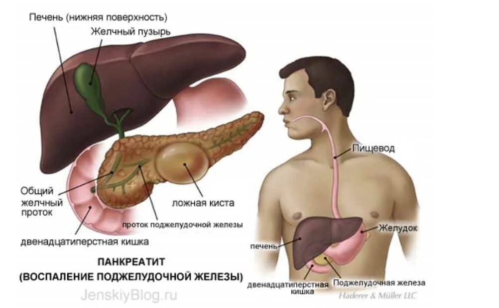 Первые симптомы поджелудочной. Поджелудочная железа фото. Фото поджелудочной железы у человека. Печень и поджелудочная железа.