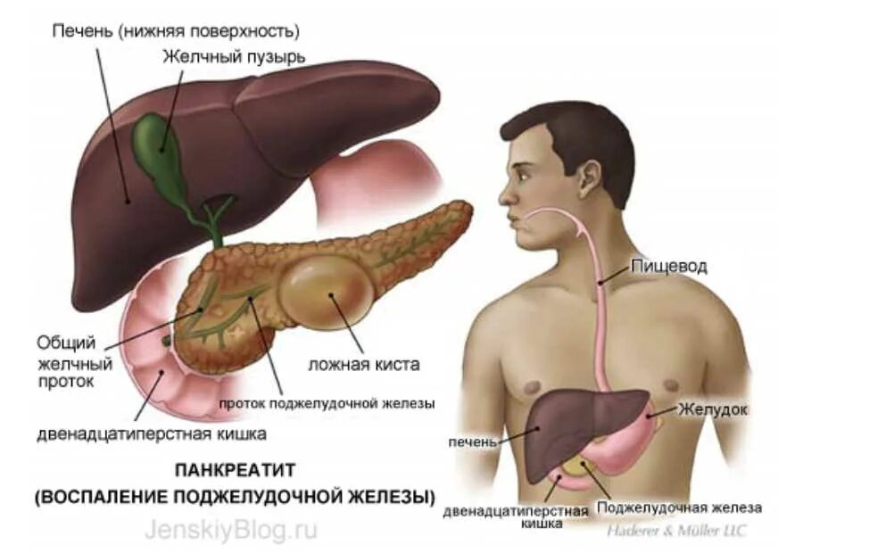 Сколько восстанавливается поджелудочная. Фото поджелудочной железы у человека. печень и поджелудочная железа. поджелудочная железа симптомы.