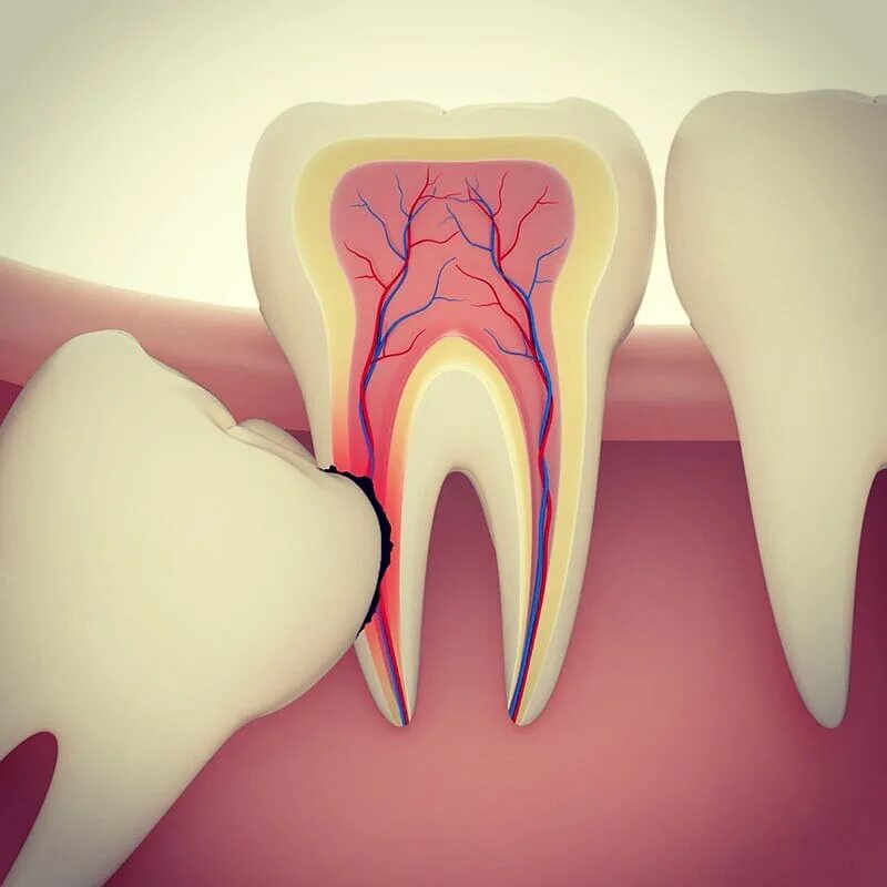 сколько вырвать зуб в москве