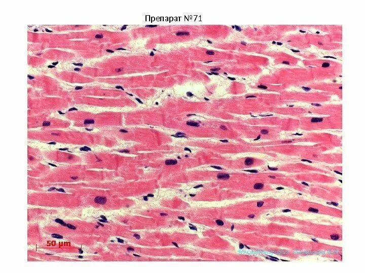 Гладкая мышечная ткань гистология. Исчерченная скелетная мышечная ткань препарат. Препараты мышечных тканей. Препараты мышечных тканей. Гистологический препарат поперечно-полосатая мышечная ткань.