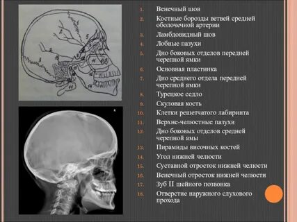 Переломы задней черепной ямки