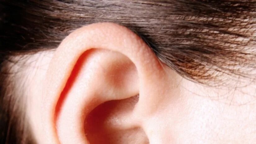 Почему уши разные. Микротия ушной раковины. Аномалии ушной раковины.