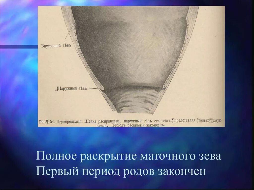 Что значит зев закрыт. Степень раскрытия маточного зева. Полное раскрытие маточного зева. Полное раскрытие шейки матки. Раскрытие маточного зева при родах.