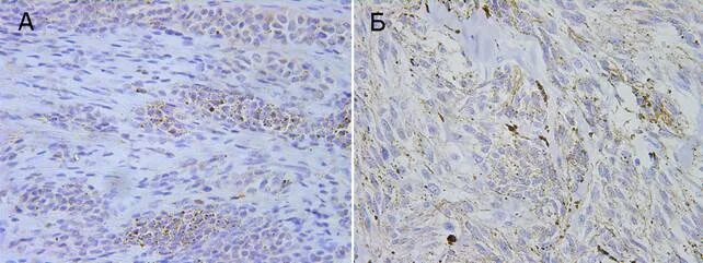 Иммуногистохимическое исследование ki-67. Контагиозный моллюск патологическая анатомия. Контагиозный моллюск патоморфология. Иммуногистохимические маркеры
