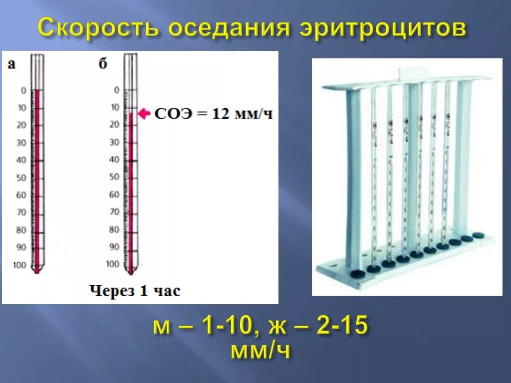 Соэ 1 мм час. Прибор Панченкова для определения СОЭ. Капилляр Панченкова измерение СОЭ. Методика постановки СОЭ. СОЭ капилляр Панченкова.