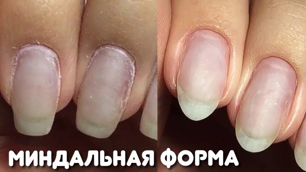 Как пилить миндальную. Опил миндальной формы. опил формы овал на коротких ногтях. как пилить ногти миндальной формы. как правильно пилить ногти миндалевидной формы.