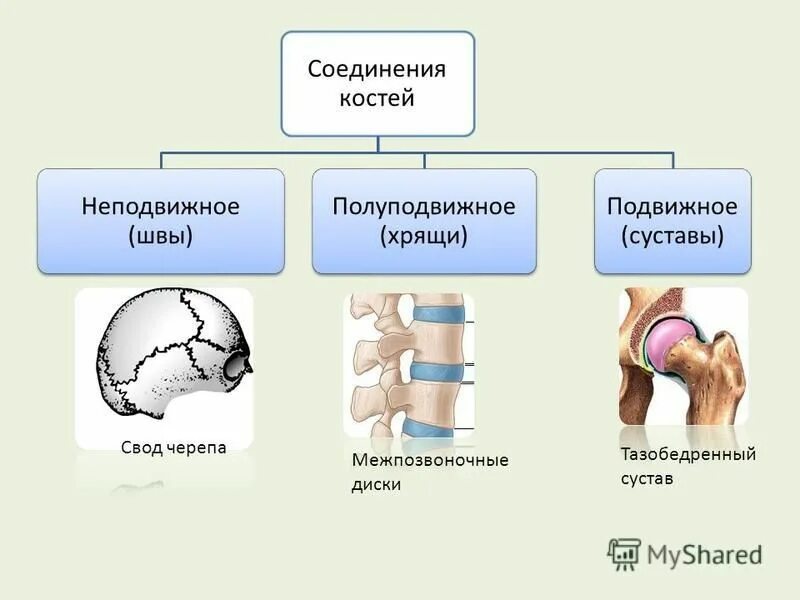 Тазовые кости тип соединения. Типы соединения костей подвижное и неподвижное. Подвижное и неподвижное соединение костей. Виды соединительных костей схема. Типы соединения костей человека.