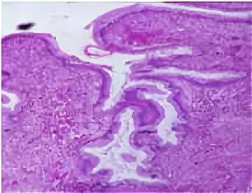 Шейка матки гистология строение. Эпителий эндоцервикса. Мышечная оболочка матки гистология. Эндоцервикс гистология. Эпителий эндоцервикса.