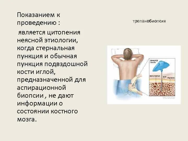 Пункция костного мозга для чего. Показания к исследованию костного мозга. стернальная пункция показания. методика пункции костного мозга. подготовка к трепанобиопсия костного мозга.