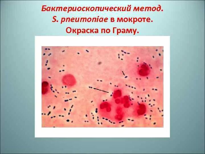 Мокрота окраска. Окрашивание мокроты по Граму. Бактериоскопический метод исследования мокроты. Бактериоскопия мазка мокроты. Микроскопия мокроты по Граму.