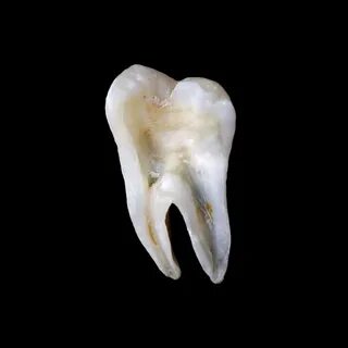 Картинки Зуб вид сверху (2025): нашлось 89 картинок