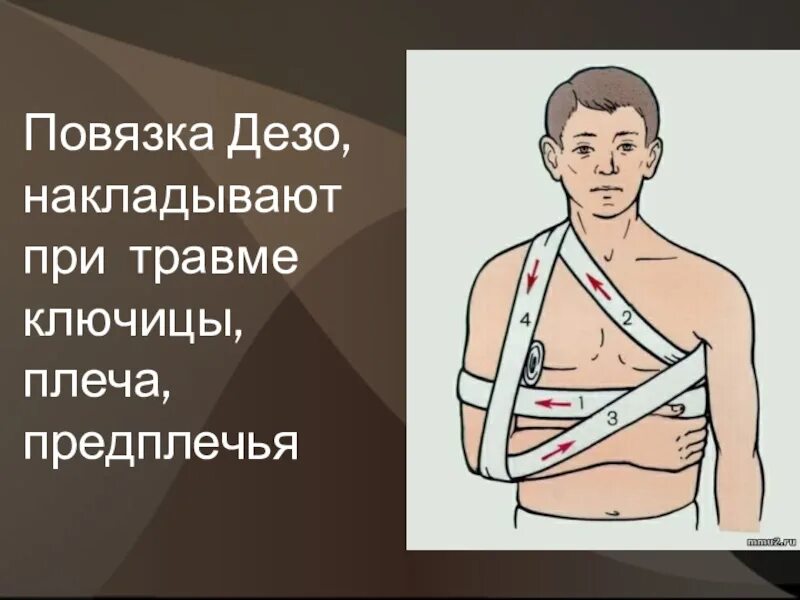 Повязки (правила наложения, виды, схемы). Повязки (правила наложения, виды, схемы). Хирургические повязки. Порядок наложения повязки при травме головы. Десмургия повязки алгоритм.