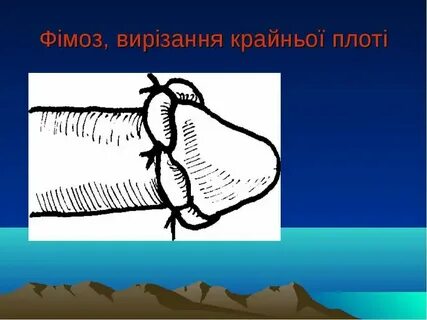 Отекшая крайняя плоть