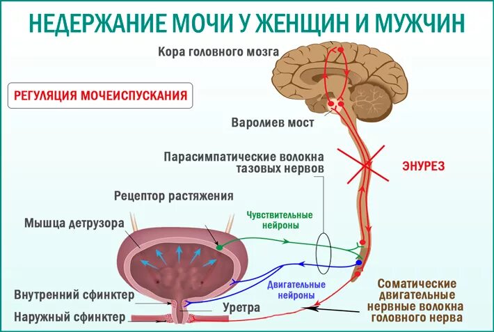 Почему у мужчины выделение. Схема процесса мочеиспускания. Причины недержания мочи. Недержание мочи у мужчин. Тотальное недержание мочи.