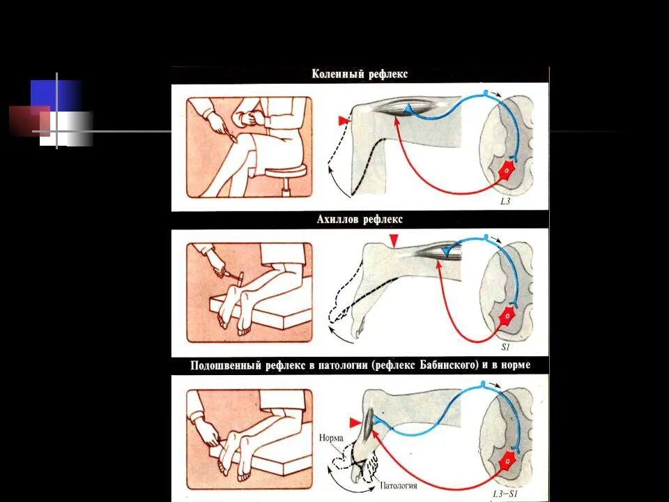 Как проверить рефлексы. Ахиллов рефлекс рефлекторная. Коленный и Ахиллов рефлексы физиология. Ахиллов рефлекс физиология дуга. Ахиллов рефлекс физиология схема.