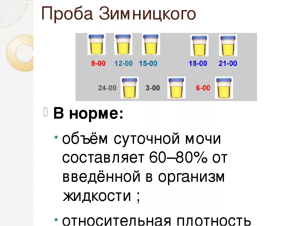 Метод исследования мочи по Зимницкому. Исследование мочи по Зимницкому алгоритм исследования. Норма анализа проба по Зимницкому. Моча по Зимницкому метод исследования.