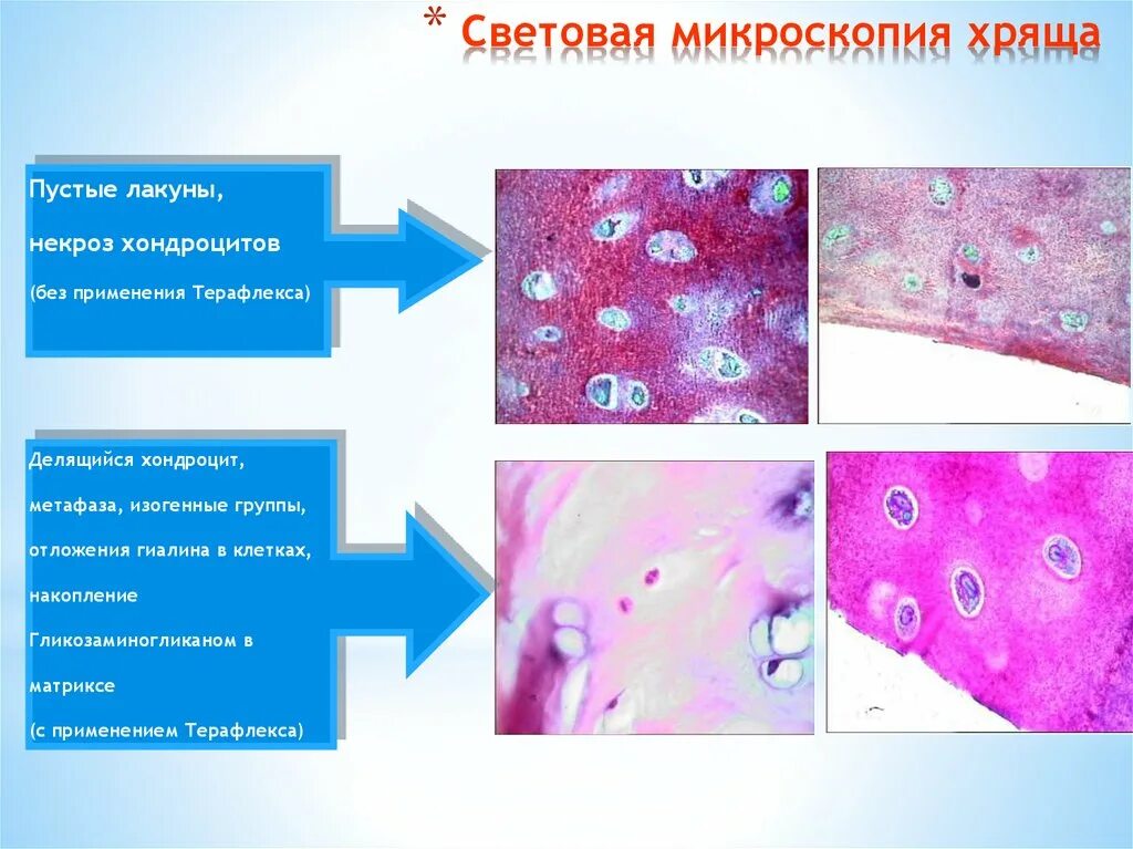 Изогенные группы. Световая микроскопия. Изогенные группы хондроцитов. Стандартная световая микроскопия. Функция хондроцитов в ткани хряща.