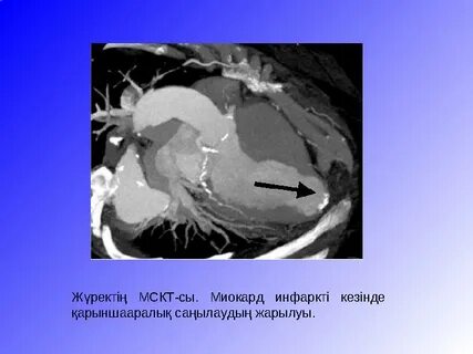 Жігіттердің есектерінің фотосы