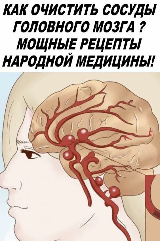 Очистка сосудов головы. Очистить сосуды головного мозга. Очищение сосудов головного. Как чистить сосуды головного мозга.