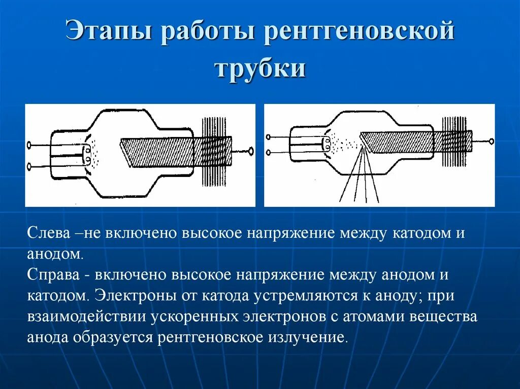 Какое напряжение на рентгеновской трубке