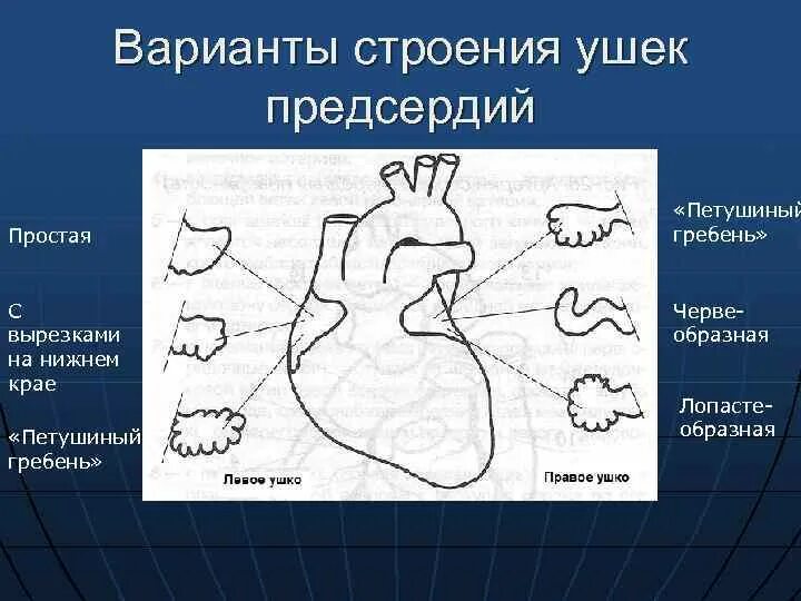 Левое ушко левого предсердия. Строение левого предсердия анатомия. Ушко предсердия. Ушко предсердия. Тромбоз ушка левого предсердия.