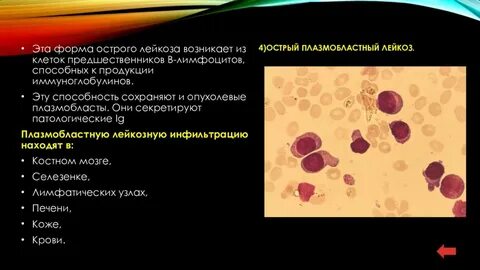 Печень при остром лейкозе