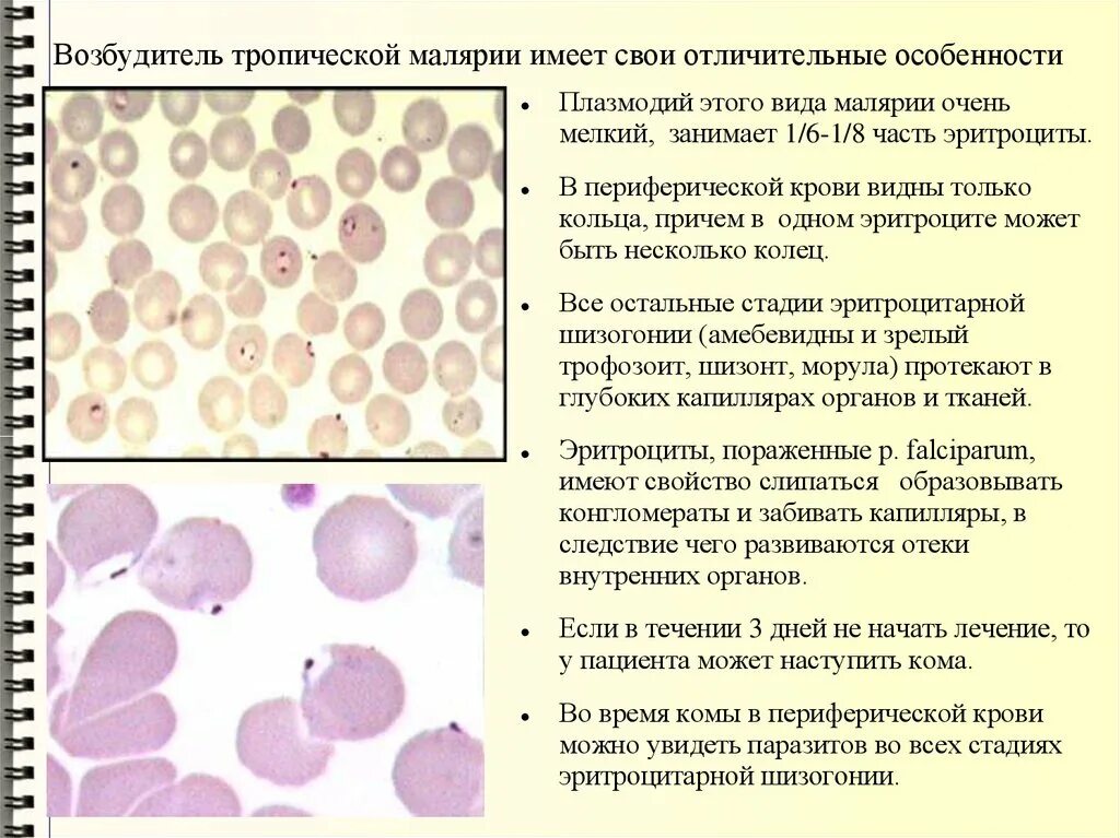 Течение тропической малярии. Малярия морфология. Эритроциты при тропической малярии. Малярийный плазмодий морфология. Малярия трехдневная морфология.