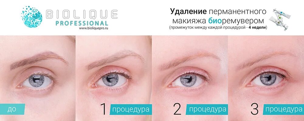 удаленный татуаж бровей ремувером. ремувер отзывы брови. ремувер для бровей. брови после лазера. тинель пигменты ремувер.