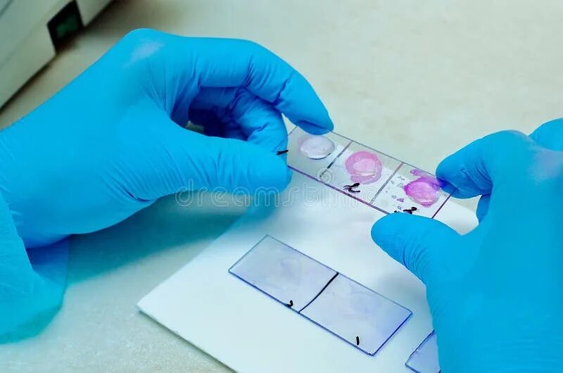 Срочные гистологические исследования. Мазок на предметном стекле. забор материала для гистологического исследования. фиксация материала для гистологического исследования. стекла гистологического исследования.