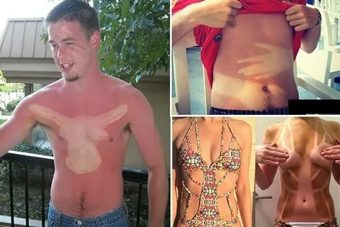 Sun worshippers show off the worst tan lines ever after spen