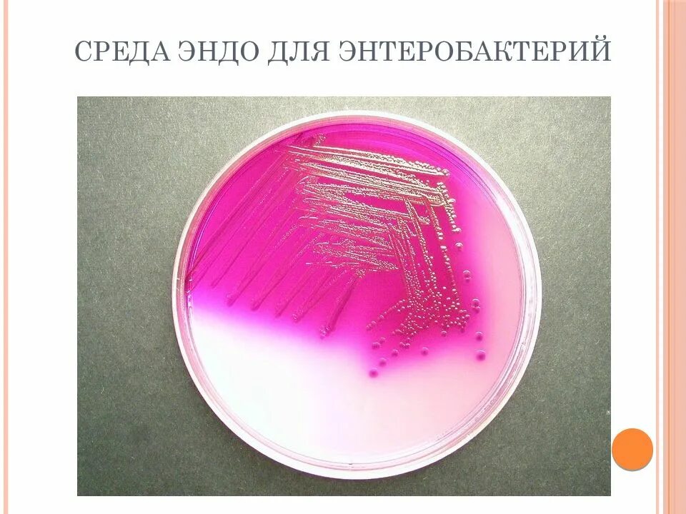 Эшерихии на среде Эндо. Энтеробактерии на среде Эндо. Кишечная палочка на среде Эндо. Среда Эндо микробиология. Среда для кишечной палочки