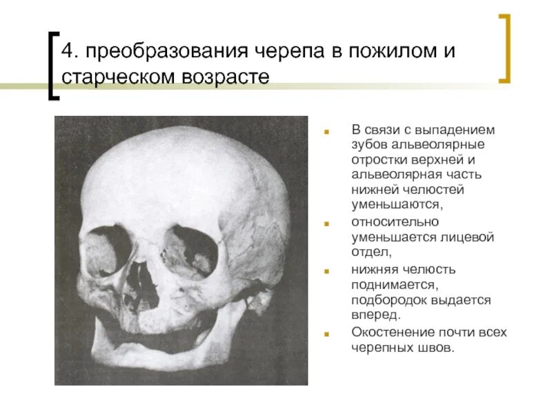 Возрастные изменения костей лицевого скелета. Возрастные изменения костей черепа. Возрастные изменения черепа анатомия. Старческие изменения костей черепа.