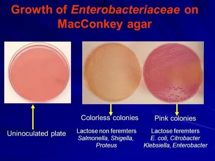 Enterobacteriaceae spp