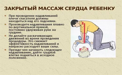 Открытый и закрытый массаж сердца. Прямой массаж сердца техника. Закрытый массаж сердца. Осложнения при закрытом массаже сердца