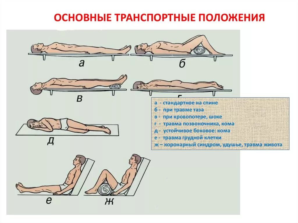 Транспортное положение пострадавшего при травме позвоночника. Транспортное положение пострадавшего при травме живота. Транспортное положение при травме позвоночника. Транспортные положения.