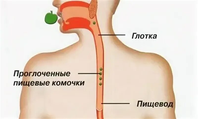 Пищевод отдает в спину. Боль в пищеводе при глотании пищи. Боль при глотании в пищеводе. Спастические сокращения пищевода.