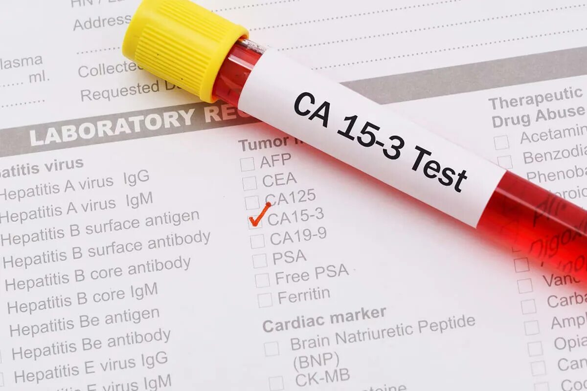 Опухолеассоциированные маркеры са 15-3. Анализ са-15-3 норма. Антиген ca 15-3. Нормы онкомаркеров у женщин са 15-3. Онкомаркеры ca 15-3.